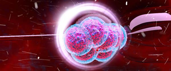 Inseminacija Sa Obradom Sperme