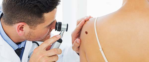 Dermatoskopija Beograd