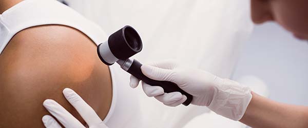 Pregled dermatologa